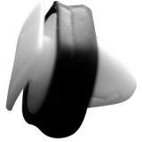 Autosmilga tüübel 10 mm avale, Peugeot/Citroën/Fiat | HL Autoosad